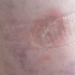 Kosmetik Studio Rottweil Oberndorf Lifting