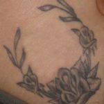 Tattooentfernung Tattoo entfernen Rottweil Balingen Albstadt-Ebingen