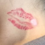 Tattoo entfernen Rottweil und Oberndorf am neckar Bad Dürrheim