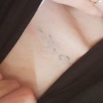 Tattoo lasern Oberndorf Rottweil Villingen Schwenningen